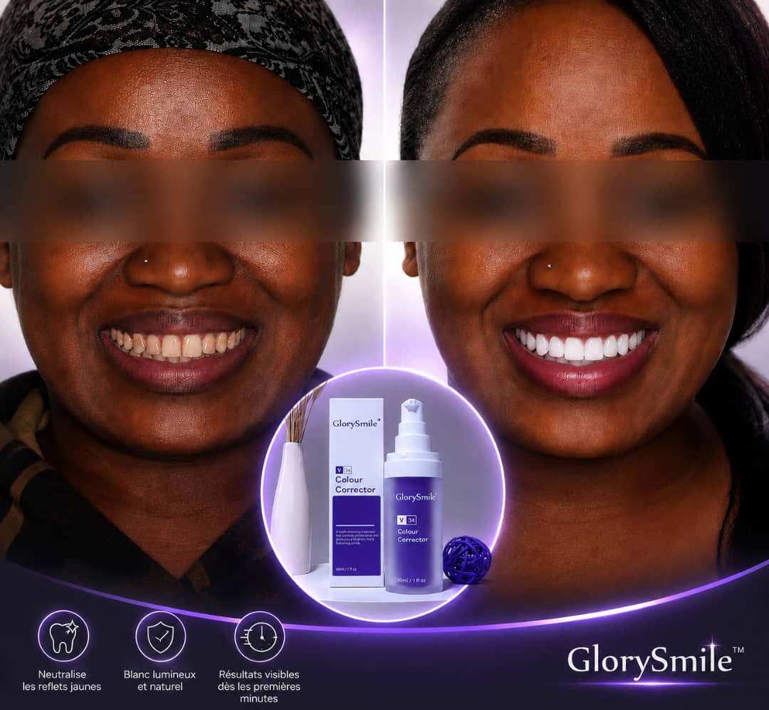 🦷 GlorySmile™ V34 – Le dentifrice ultra blanchissant qui révèle un sourire charmeur